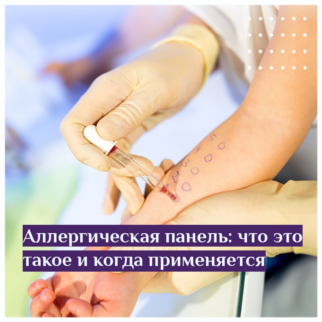 Аллергическая панель что это такое и когда применяется