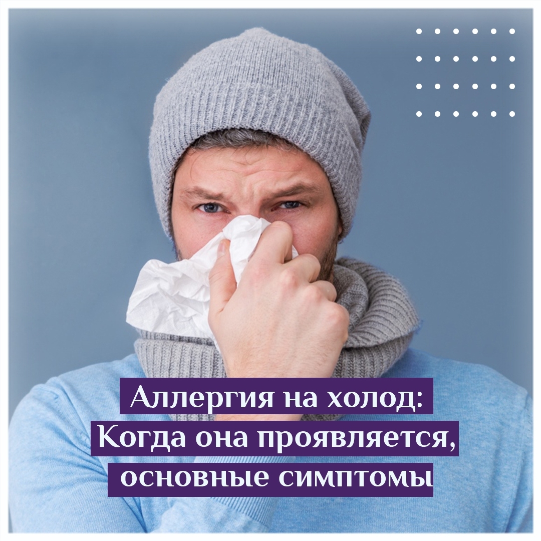 Аллергия на холод когда она проявляется основные симптомы