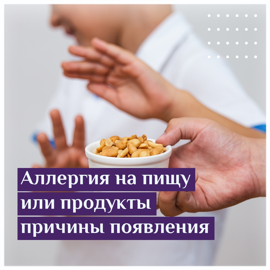 Аллергия на пищу или продукты причины появления
