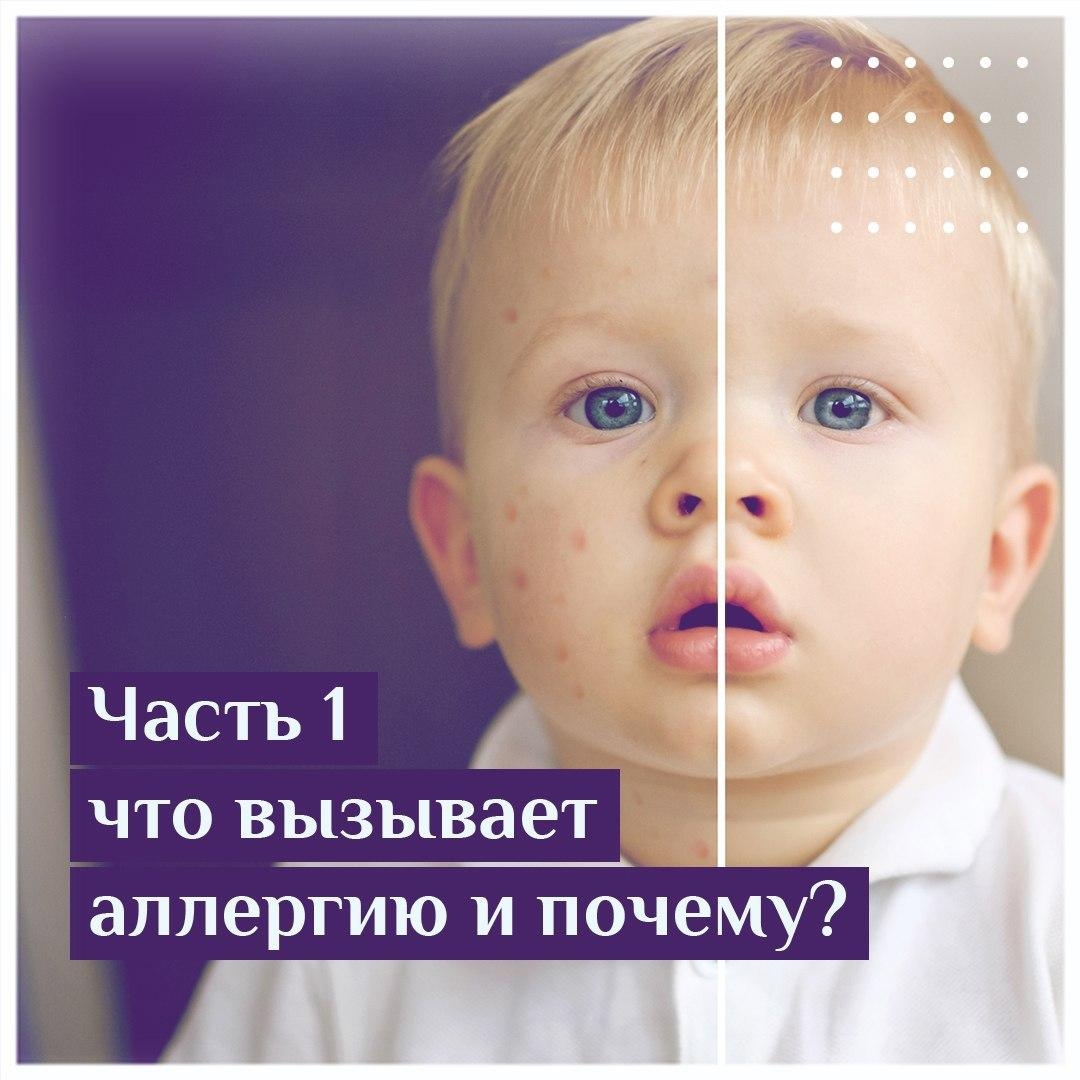 Часть 1 что вызывает аллергию и почему?